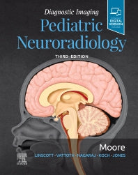 Diagnostic Imaging: Pediatric Neuroradiology (Hardback) 9780323680318