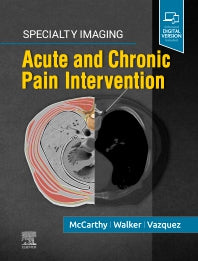 Specialty Imaging: Acute and Chronic Pain Intervention (Hardback) 9780323680363