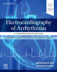 Electrocardiography of Arrhythmias: A Comprehensive Review (Paperback / softback) 9780323680509