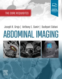 Abdominal Imaging; The Core Requisites (Paperback / softback) 9780323680615