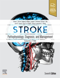 Stroke; Pathophysiology, Diagnosis, and Management (Hardback) 9780323694247