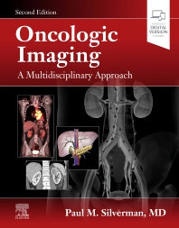 Oncologic Imaging: A Multidisciplinary Approach (Hardback) 9780323695381