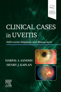 Clinical Cases in Uveitis; Differential Diagnosis and Management (Paperback / softback) 9780323695411