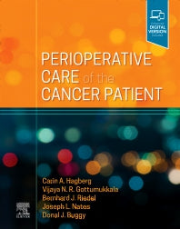 Perioperative Care of the Cancer Patient (Hardback) 9780323695848