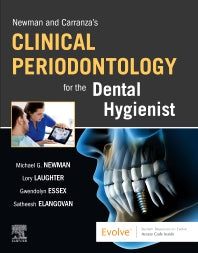 Newman and Carranza’s Clinical Periodontology for the Dental Hygienist (Paperback / softback) 9780323708418