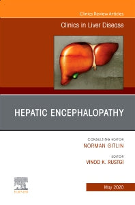 Drug Hepatotoxicity,An Issue of Clinics in Liver Disease (Hardback) 9780323708579