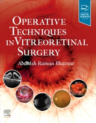 Operative Techniques in Vitreoretinal Surgery (Hardback) 9780323709200
