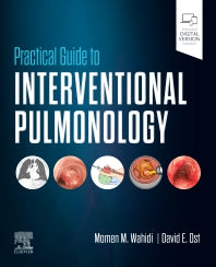 Practical Guide to Interventional Pulmonology (Hardback) 9780323709545