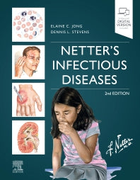 Netter's Infectious Diseases (Hardback) 9780323711593
