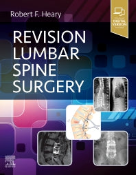 Revision Lumbar Spine Surgery (Hardback) 9780323712019