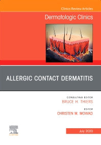 Allergic Contact Dermatitis,An Issue of Dermatologic Clinics (Hardback) 9780323712132