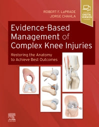 Evidence-Based Management of Complex Knee Injuries; Restoring the Anatomy to Achieve Best Outcomes (Hardback) 9780323713108