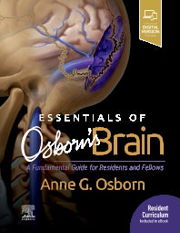 Essentials of Osborn's Brain; A Fundamental Guide for Residents and Fellows (Hardback) 9780323713207