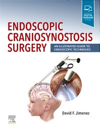 Endoscopic Craniosynostosis Surgery; An Illustrated Guide to Endoscopic Techniques (Hardback) 9780323721752