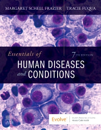 Essentials of Human Diseases and Conditions (Paperback / softback) 9780323749695