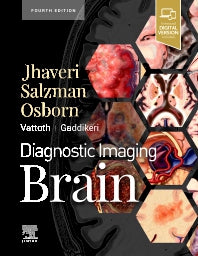 Diagnostic Imaging: Brain (Hardback) 9780323756204