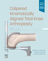 Calipered Kinematically aligned Total Knee Arthroplasty; Theory, Surgical Techniques and Perspectives (Hardback) 9780323756266