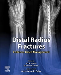 Distal Radius Fractures; Evidence-Based Management (Hardback) 9780323757645