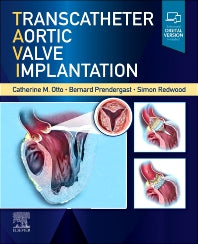 Transcatheter Aortic Valve Implantation (Hardback) 9780323757928