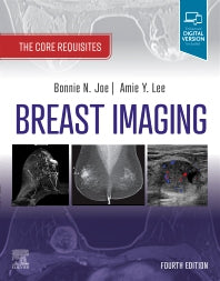 Breast Imaging; The Core Requisites (Paperback / softback) 9780323758499