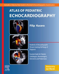 Atlas of Pediatric Echocardiography (Paperback / softback) 9780323759816