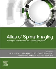 Atlas of Spinal Imaging; Phenotypes, Measurements and Classification Systems (Paperback / softback) 9780323761116