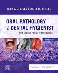 Oral Pathology for the Dental Hygienist (Hardback) 9780323764032