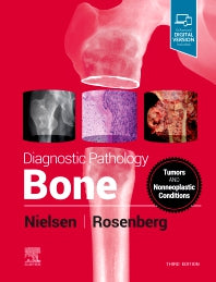 Diagnostic Pathology: Bone (Hardback) 9780323765336