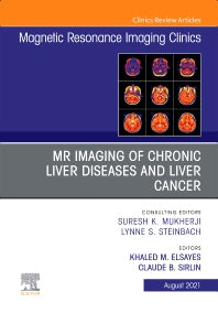 MR Imaging of Chronic Liver Diseases and Liver Cancer, An Issue of Magnetic Resonance Imaging Clinics of North America (Hardback) 9780323776134