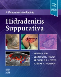 A Comprehensive Guide to Hidradenitis Suppurativa (Hardback) 9780323777247