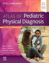 Zitelli and Davis' Atlas of Pediatric Physical Diagnosis (Hardback) 9780323777889