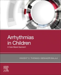 Arrhythmias in Children; A Case-Based Approach (Paperback / softback) 9780323779074