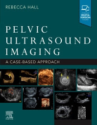 Pelvic Ultrasound Imaging; A Cased-Based Approach (Paperback / softback) 9780323789783