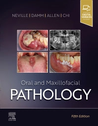 Oral and Maxillofacial Pathology (Hardback) 9780323789813