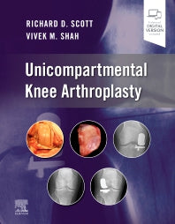 Unicompartmental Knee Arthroplasty (Hardback) 9780323790109