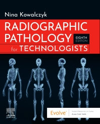 Radiographic Pathology for Technologists (Paperback / softback) 9780323791298