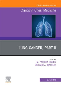 Lung Cancer, Part II, An Issue of Clinics in Chest Medicine (Hardback) 9780323791427