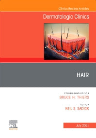 Hair, An Issue of Dermatologic Clinics (Hardback) 9780323791618