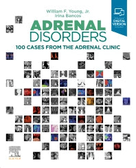 Adrenal Disorders; 100 Cases from the Adrenal Clinic (Hardback) 9780323792851