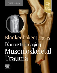 Diagnostic Imaging: Musculoskeletal Trauma (Hardback) 9780323793933
