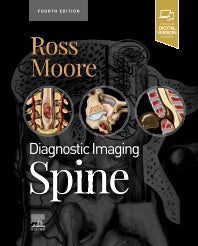 Diagnostic Imaging: Spine (Hardback) 9780323793995