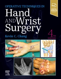 Operative Techniques: Hand and Wrist Surgery (Hardback) 9780323794152