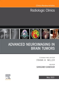 Advanced Neuroimaging in Brain Tumors, An Issue of Radiologic Clinics of North America (Hardback) 9780323794213