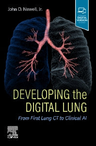 Developing the Digital Lung; From First Lung CT to Clinical AI (Paperback / softback) 9780323795012