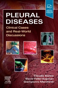 Pleural Diseases; Clinical Cases and Real-World Discussions (Paperback / softback) 9780323795418