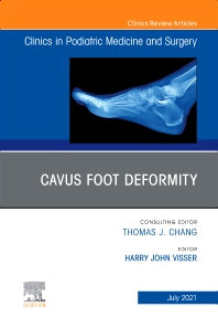 Cavus Foot Deformity, An Issue of Clinics in Podiatric Medicine and Surgery (Hardback) 9780323795951