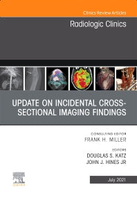 Update on Incidental Cross-sectional Imaging Findings, An Issue of Radiologic Clinics of North America (Hardback) 9780323796484