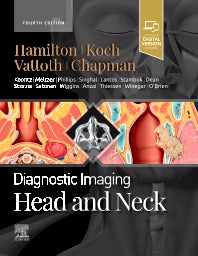 Diagnostic Imaging: Head and Neck (Hardback) 9780323796507
