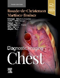 Diagnostic Imaging: Chest (Hardback) 9780323796637