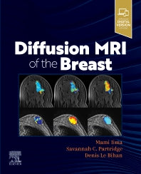 Diffusion MRI of the Breast (Paperback / softback) 9780323797023